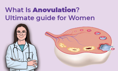 What Is Anovulation? Ultimate guide for Women
