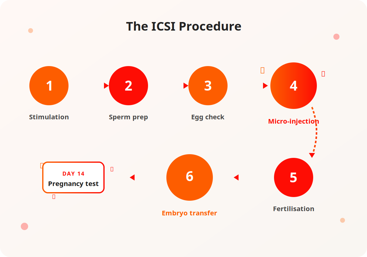 The 6 steps of ICSI procedure